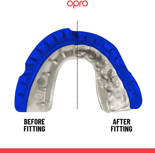 Opro Mouthguard Self-fit Gen5 Dark Blue Pearl Braces